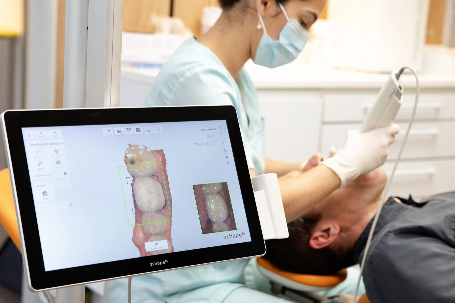 camera-empreinte-optique-orthodontie-meylan